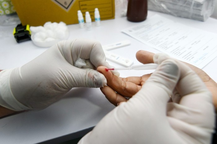 Nova Iguaçu intensifica ações no tratamento contra o HIV/AIDS