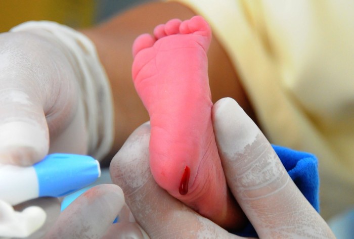 Maternidade Mariana Bulhões agiliza exame do teste do pezinho em ação na próxima terça-feira (6)