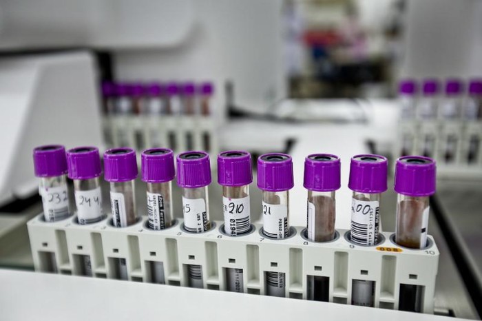 Coletas para exames aumentam 50% em UBSs de Planaltina